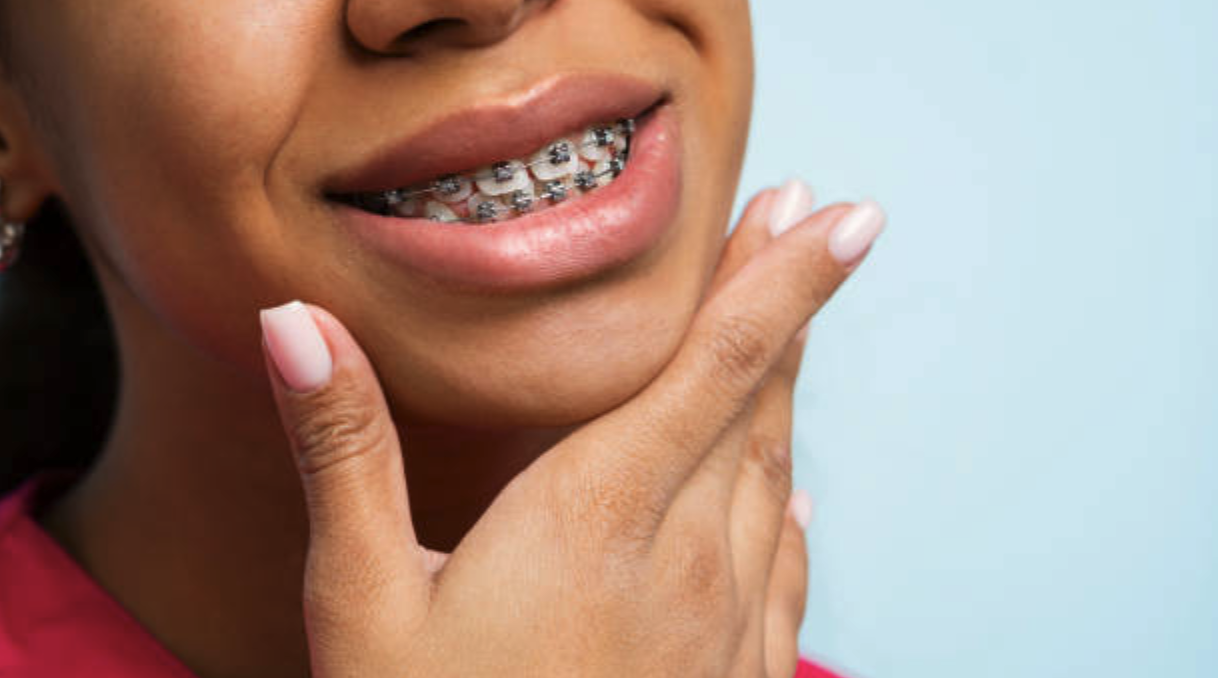 A close-up picture of a young girl smiling with braces on.